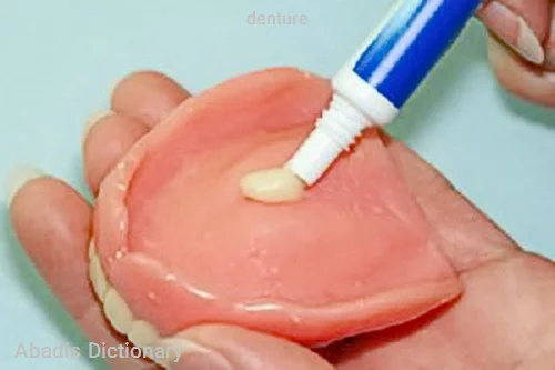 denture