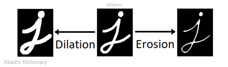 dilation