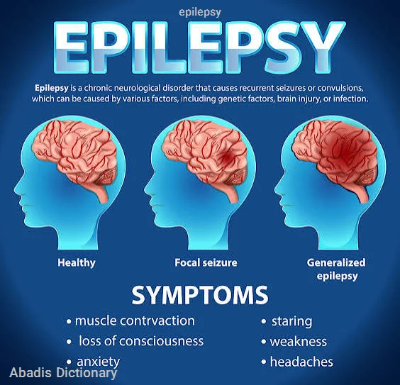 epilepsy