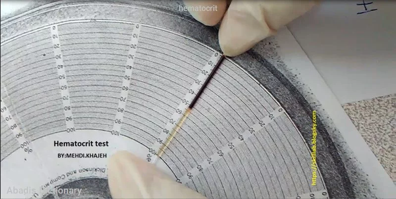 hematocrit