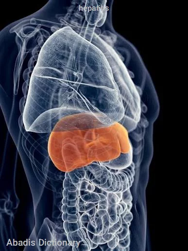 hepatitis