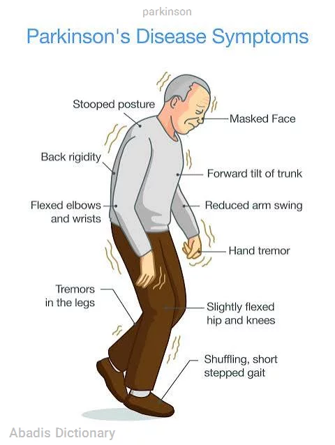 parkinson