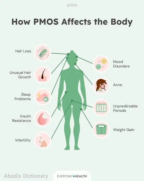 pcos