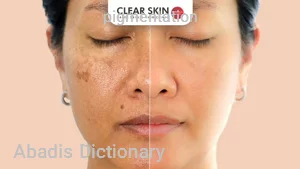 pigmentation