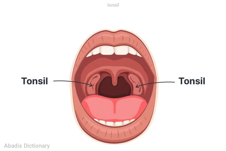 tonsil