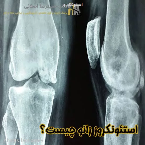 استئونکلوروز