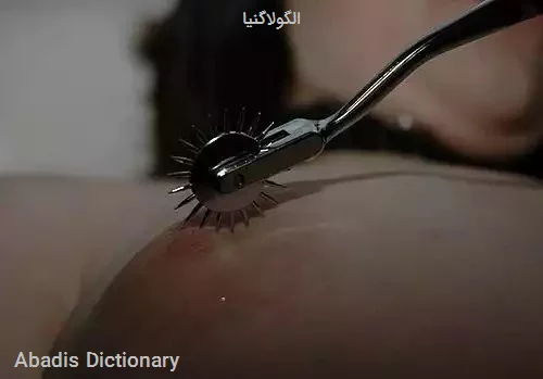 الگولاگنیا