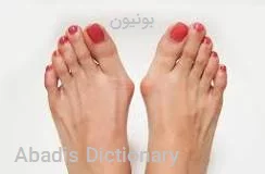 بونیون