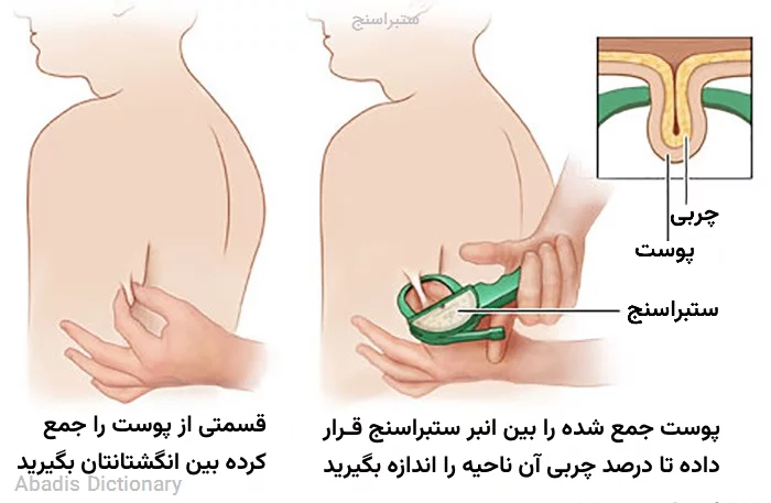 ستبراسنج