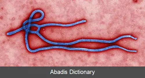 عکس بیماری ویروسی ابولا