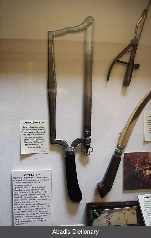 عکس اره آمپوتاسیون