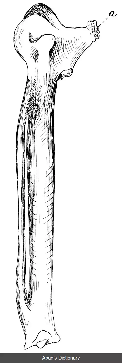 عکس استخوان مچی