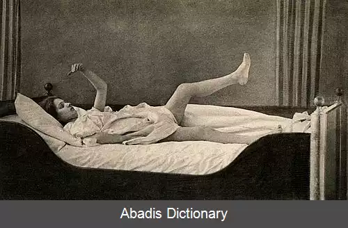 عکس انعطاف پذیری مومی