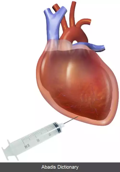 عکس بزل آب شامه