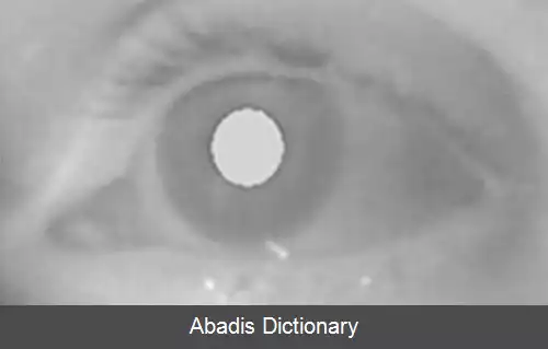 عکس ردیابی چشم