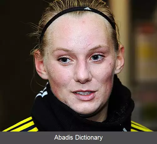 عکس استینا بلکستنیوس