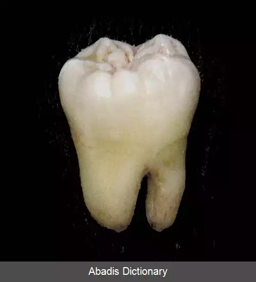 عکس دندان های آسیای بزرگ