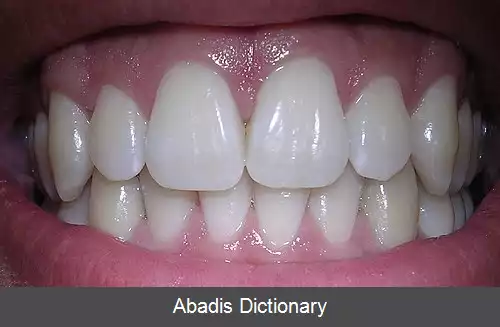 عکس بهداشت دهان و دندان