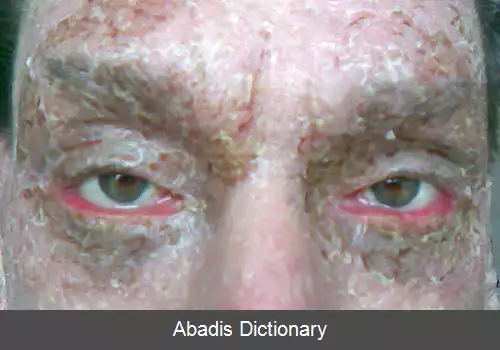 عکس برون برگشتگی