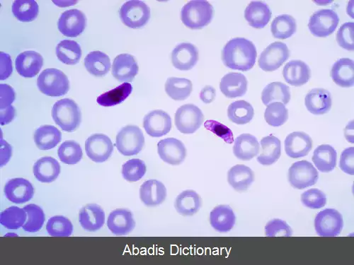 عکس پلاسمودیوم فالسیپاروم