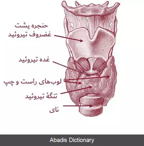 عکس فلج دوره ای تیروتوکسیک