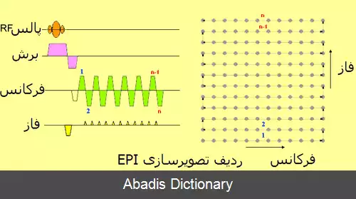 عکس تصویربرداری مسطح پژواکی