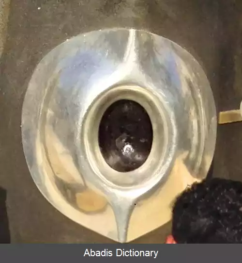 عکس فرقه باروری