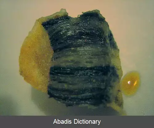 عکس چربی بلابر