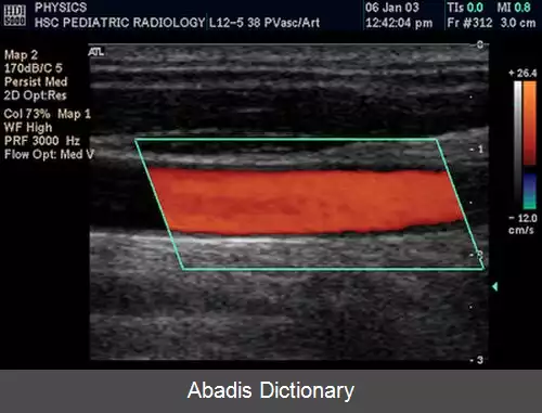 عکس سونوگرافی فراصوتی داپلر