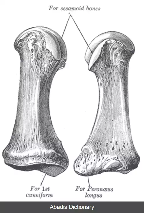 عکس استخوان کف پایی اول