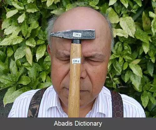 عکس مغناطیس انسانی