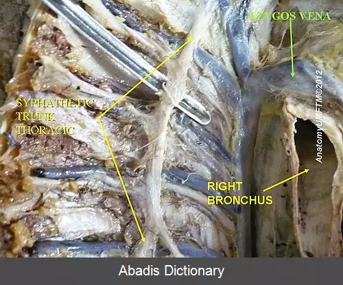 عکس سیاهرگ تکی
