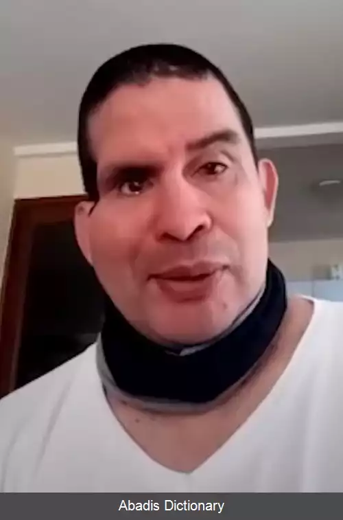 عکس فرناندو کاسرس