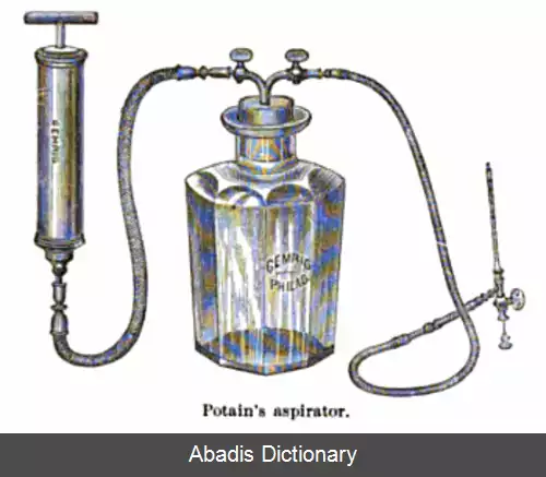 عکس آسپیراتور (ابزار پزشکی)