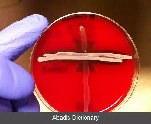 عکس استرپتوکوک آگالاکتیه