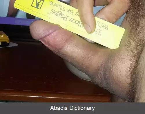عکس اندازه آلت انسان
