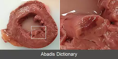 عکس ماهیچه پاپیلاری