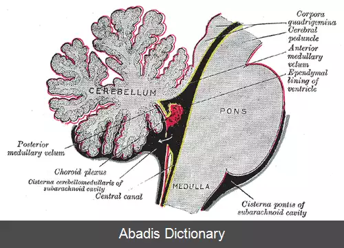 عکس استئودیستروفی ارثی آلبرایت