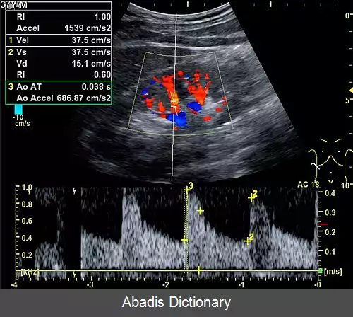 عکس سونوگرافی فراصوتی داپلر