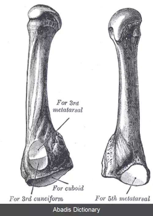 عکس استخوان کف پایی چهارم