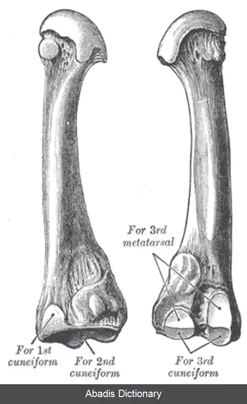 عکس استخوان کف پایی دوم