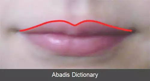 عکس کمان کوپید