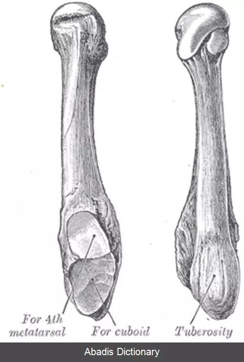 عکس استخوان کف پایی پنجم