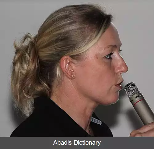 عکس زیلکه اتو