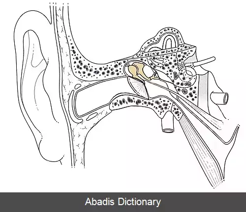 عکس استاپدکتومی