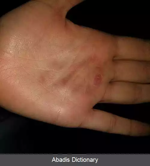 عکس چالش نمک و یخ