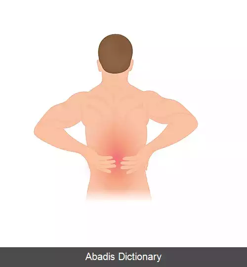 عکس علل بروز کمردرد