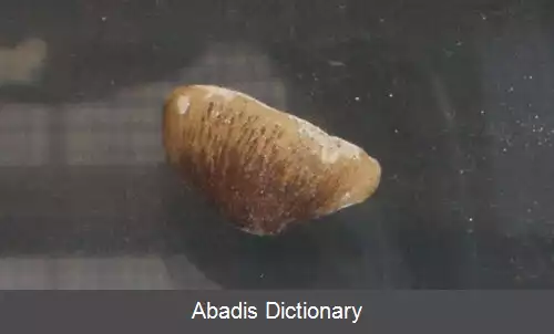 عکس کارینودنس