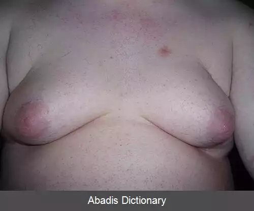 عکس آدیپوماستی