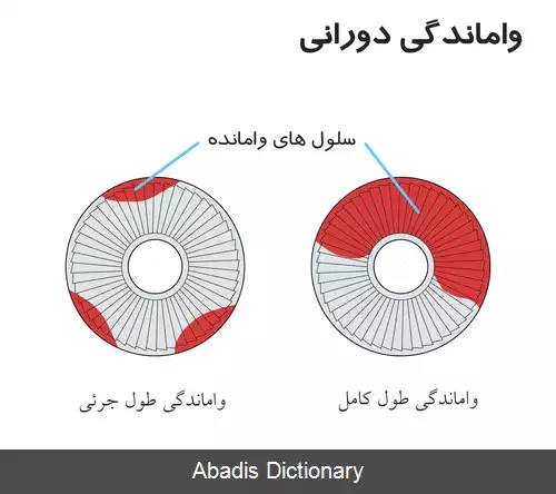 عکس واماندگی کمپرسور